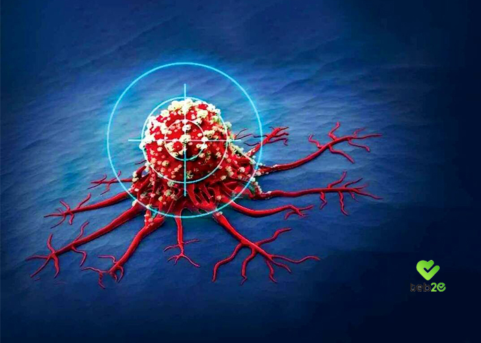 ناگفته‌هایی درباره نحوه پیشگیری از ابتلا به سرطان